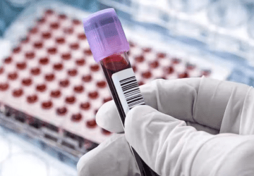 Novo exame de sangue ajuda a detectar Alzheimer e demência